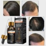 hair-growth-essential-oil-1699106314-65464e0a14bee.jpg